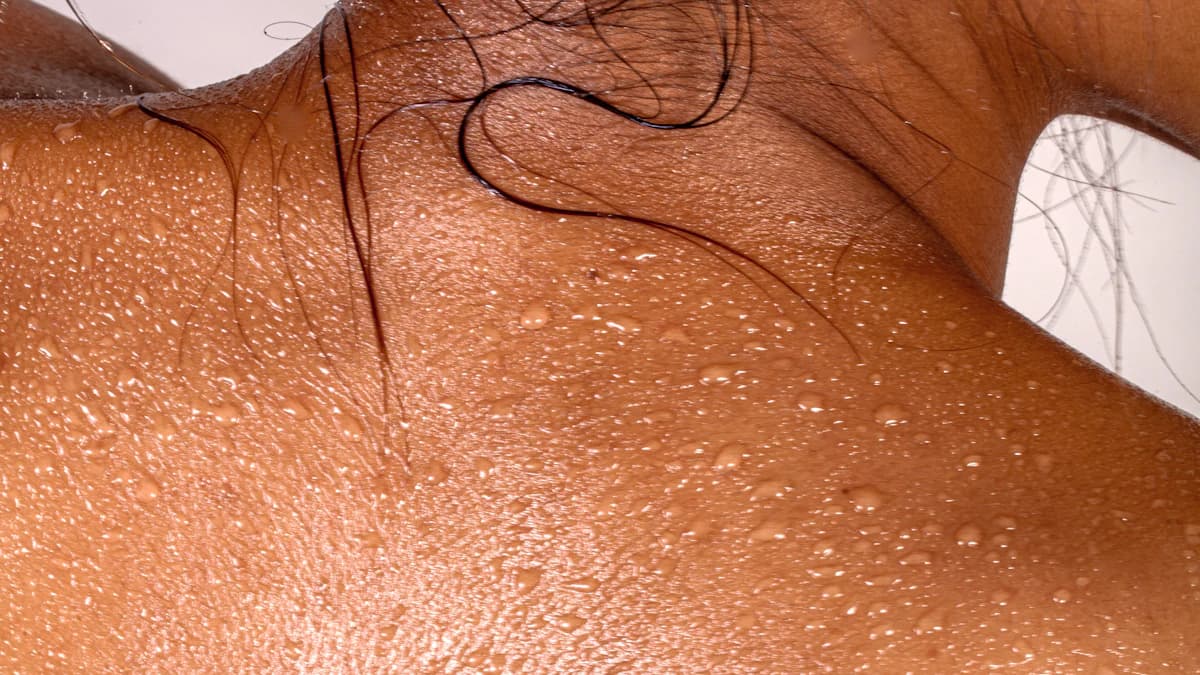 Patient bespreekt cosmetische dermatologie, kosten en veiligheid