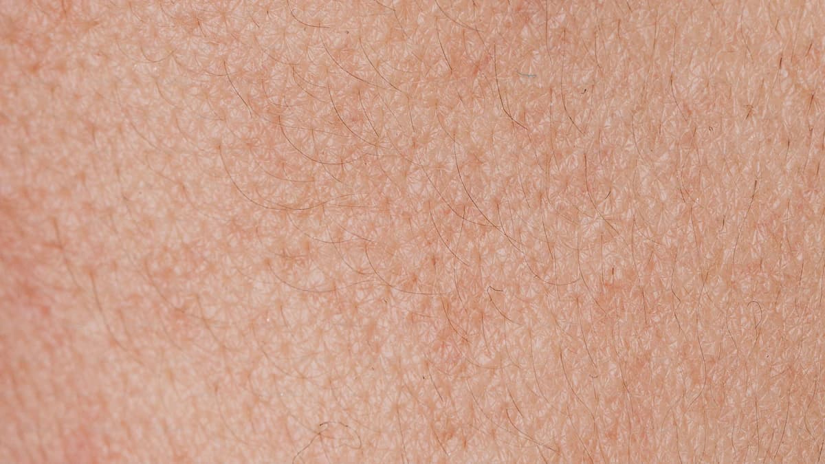 Dermatoloog bespreekt huidklachten en verwijzing met een patient