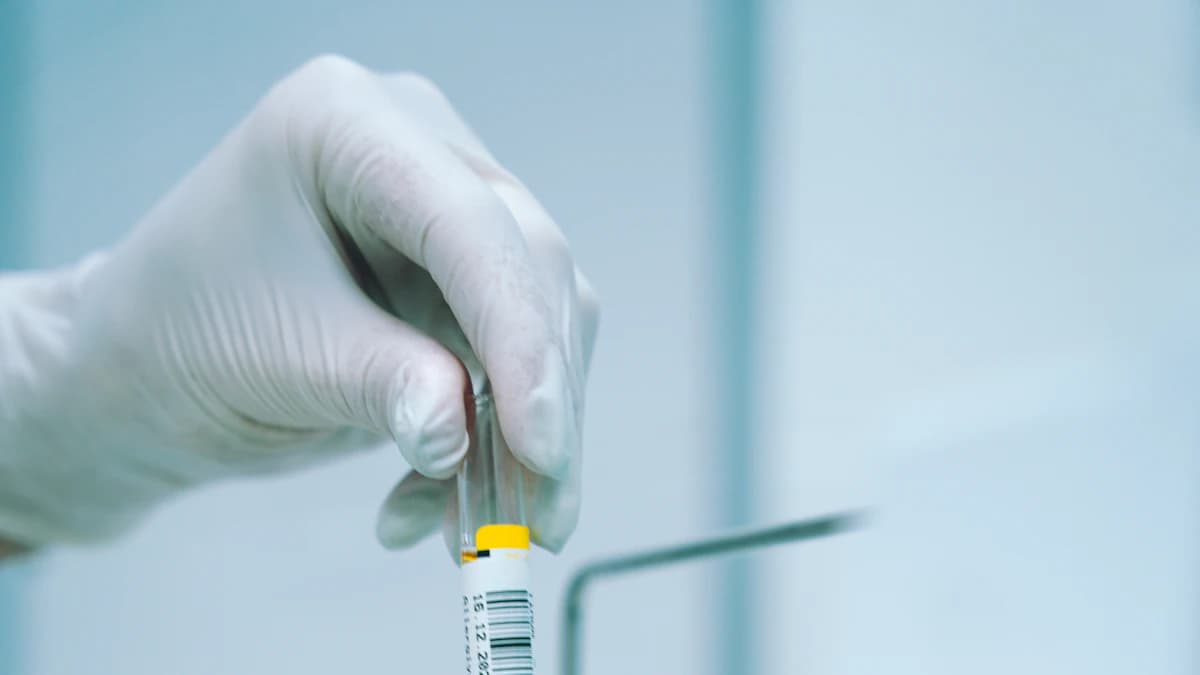 Voorbereiding op een intake bij een hormoonspecialist met vragenlijst en medicatieoverzicht
