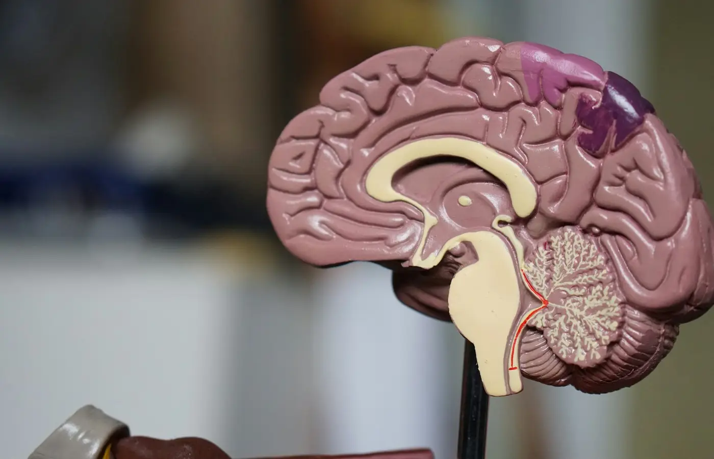 Cliënt krijgt uitleg over spiertesten bij kinesiologie