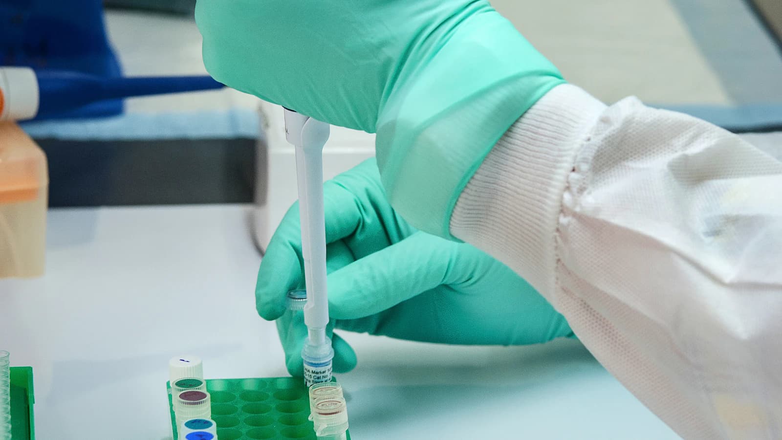Plasma doneren in 2026: waarom er vraag is
